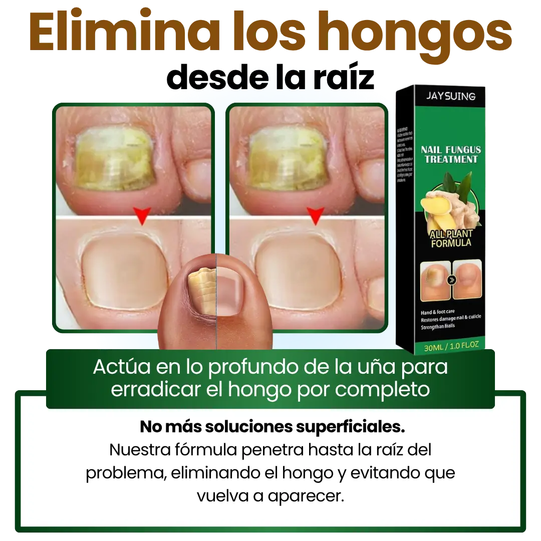 Serum para hongos