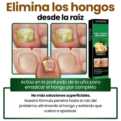 Serum para hongos
