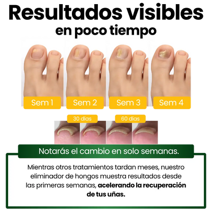 Serum para hongos