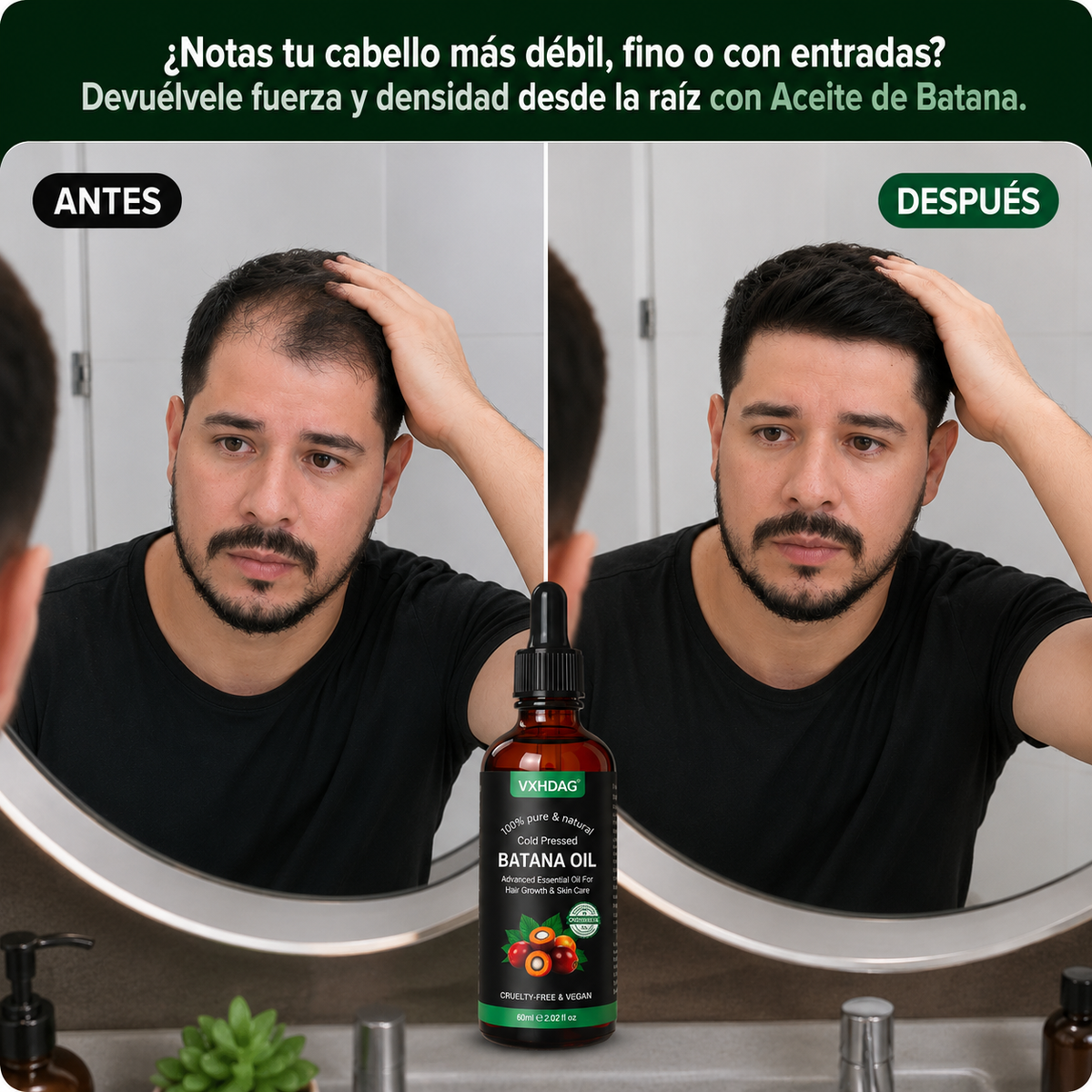 ¿Cada día pierdes más cabello? Fortalece tu raíz con Aceite de Batana