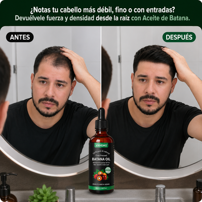 ¿Cada día pierdes más cabello? Fortalece tu raíz con Aceite de Batana
